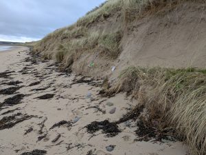 Typical situation across Ireland where the embryo and foredunes are ost to footfall leaving the less tolerant marram dunes exposed and collapsing